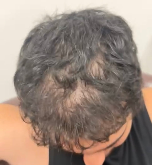 Before - AH