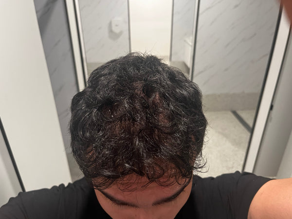 After - AH
